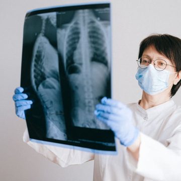 Radiologia: l’Intelligenza Artificiale non è ancora competitiva rispetto agli umani