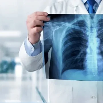 Arriva il marchio CE per il sistema AI che legge le radiografie senza supervisione umana