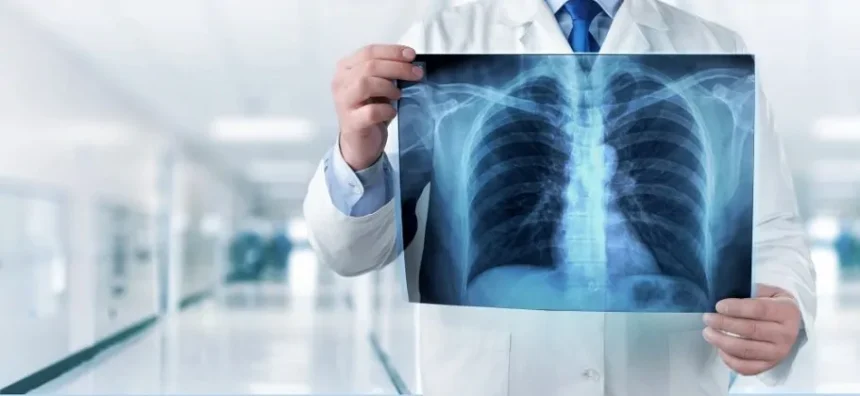 Arriva il marchio CE per il sistema AI che legge le radiografie senza supervisione umana